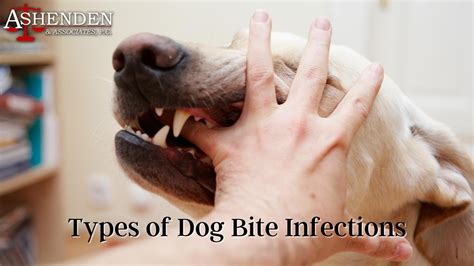 naris doh|Animal Bite .